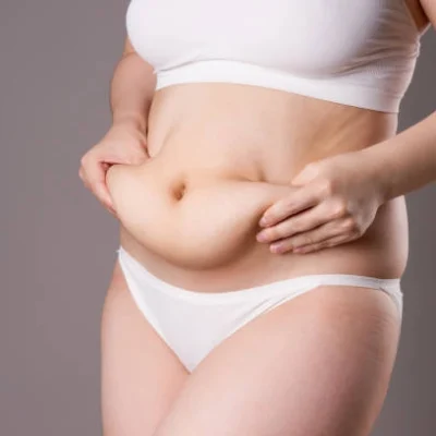 abdominoplastie_