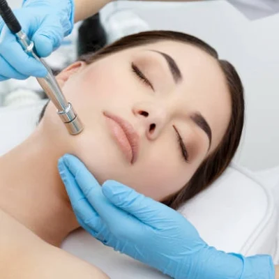microdermabrasion__